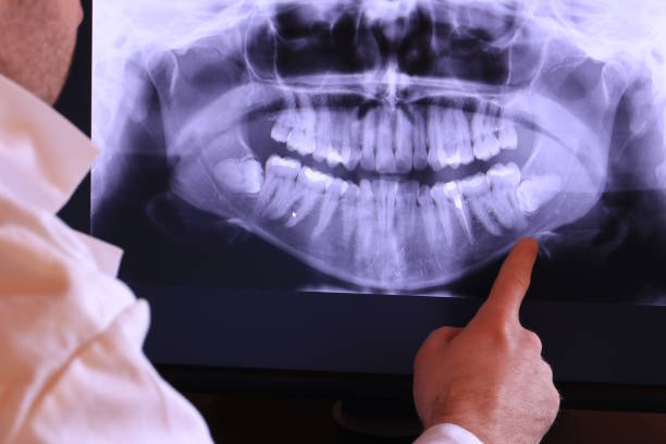 Best Emergency Tooth Extraction  in Oakhurst, CA