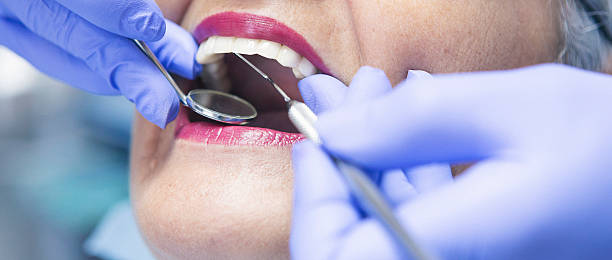 Best Teeth Whitening  in Oakhurst, CA